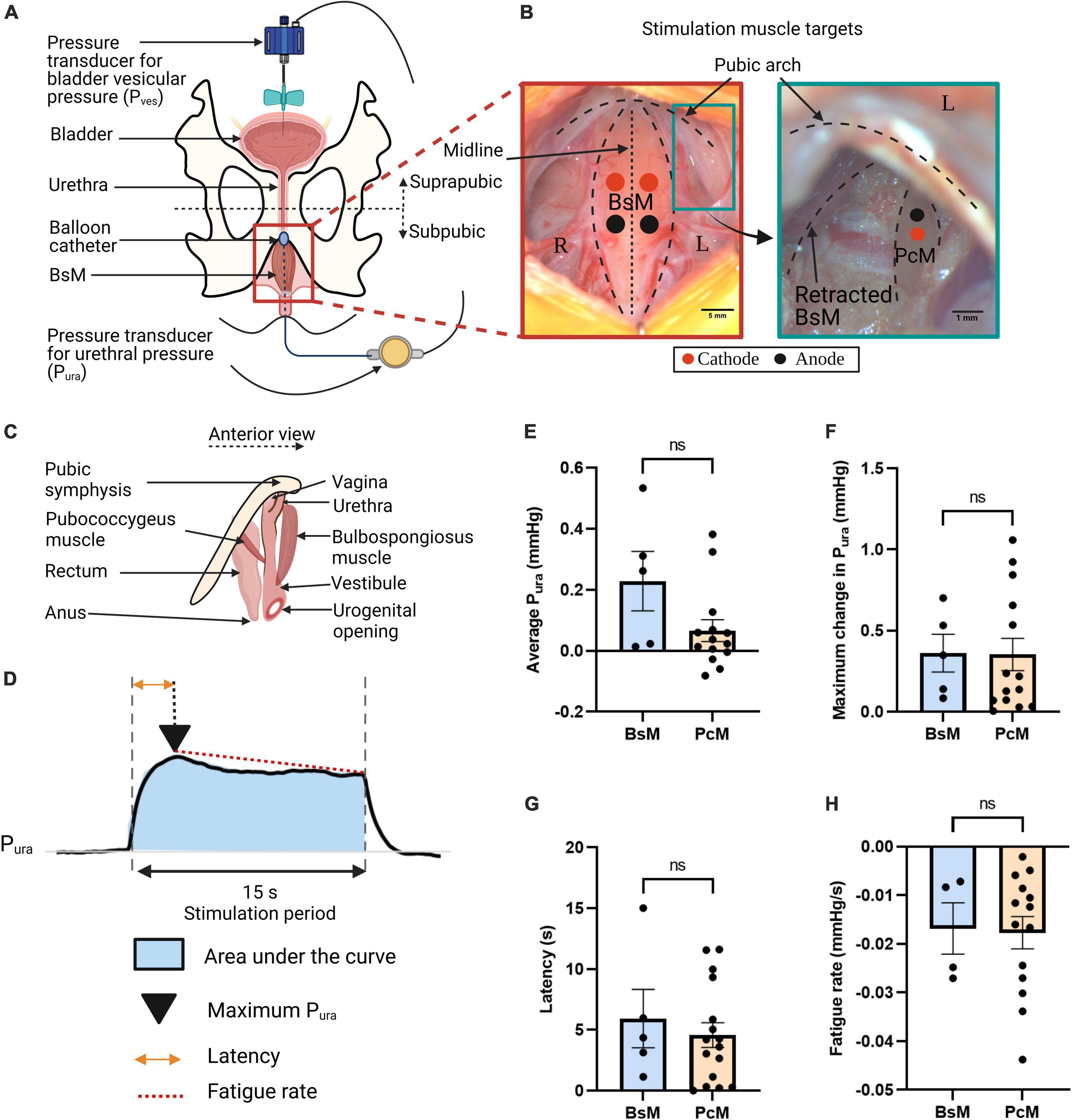 Secondary urethral sphincter function of the rabbit pelvic and perineal muscles